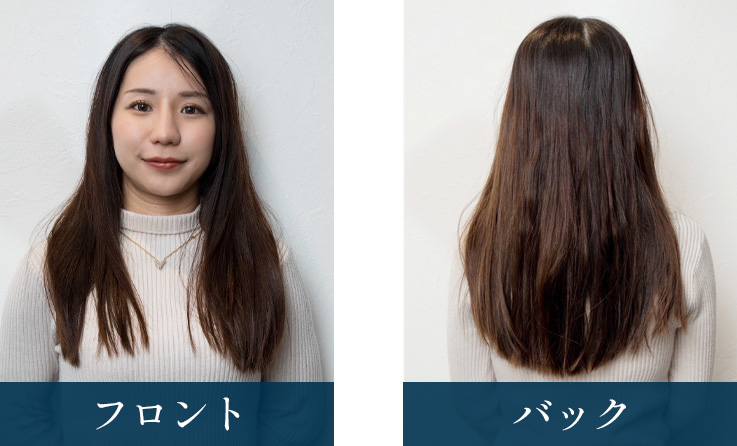 施術前の女性
