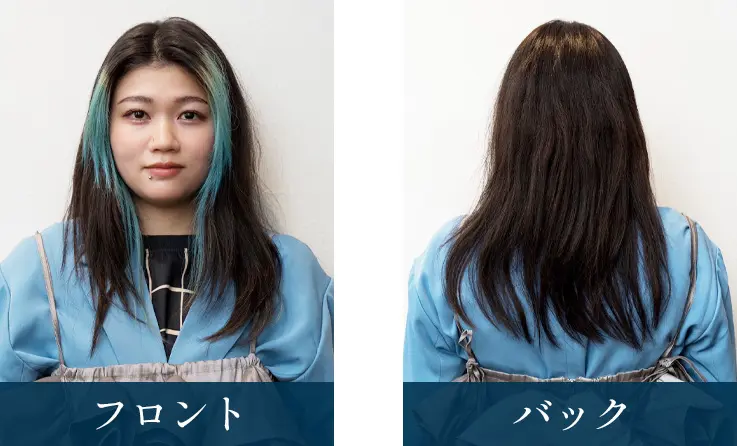 施術前の女性